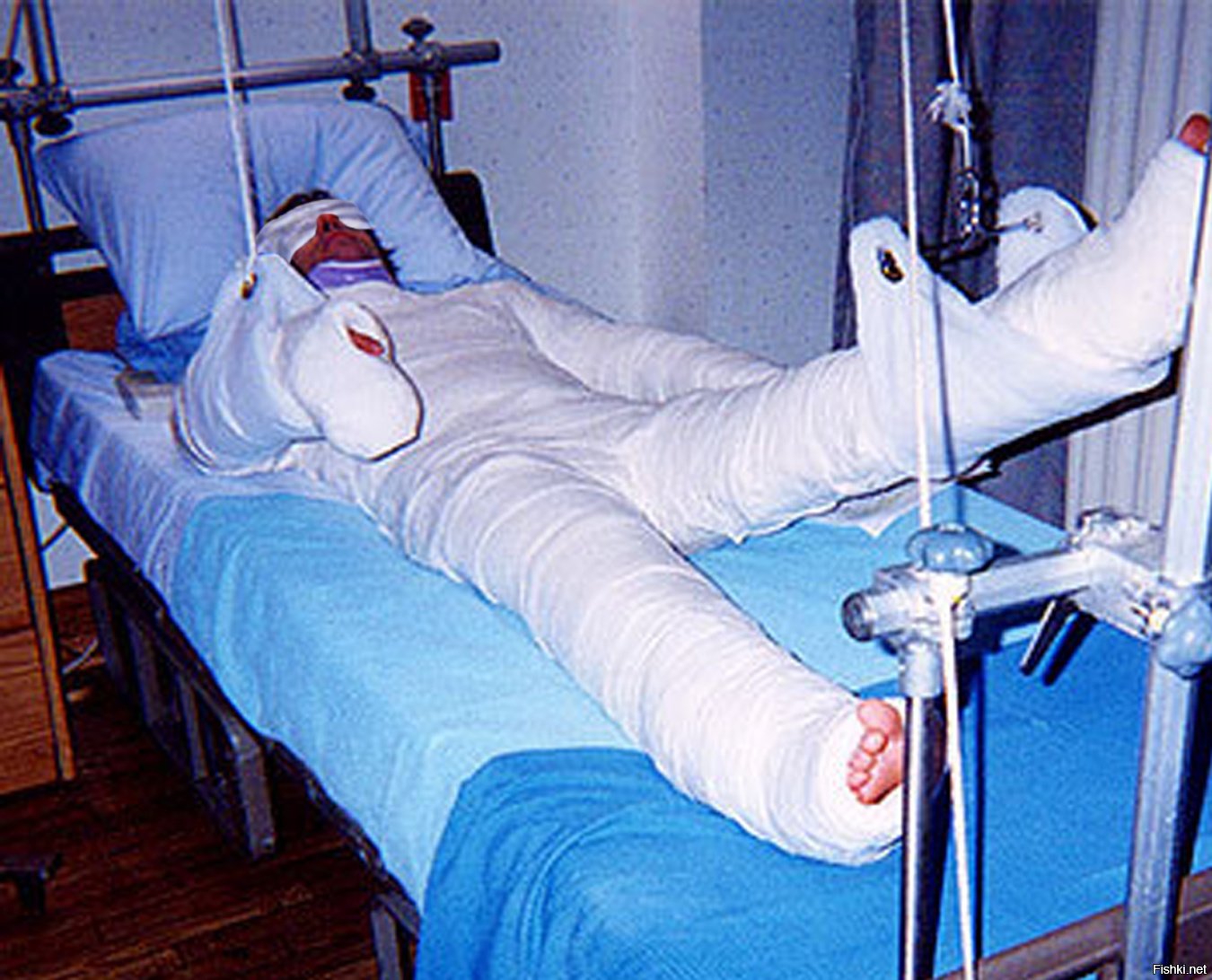 Перемещение пациента из положения лежа на кровати в положение сидя на кровати