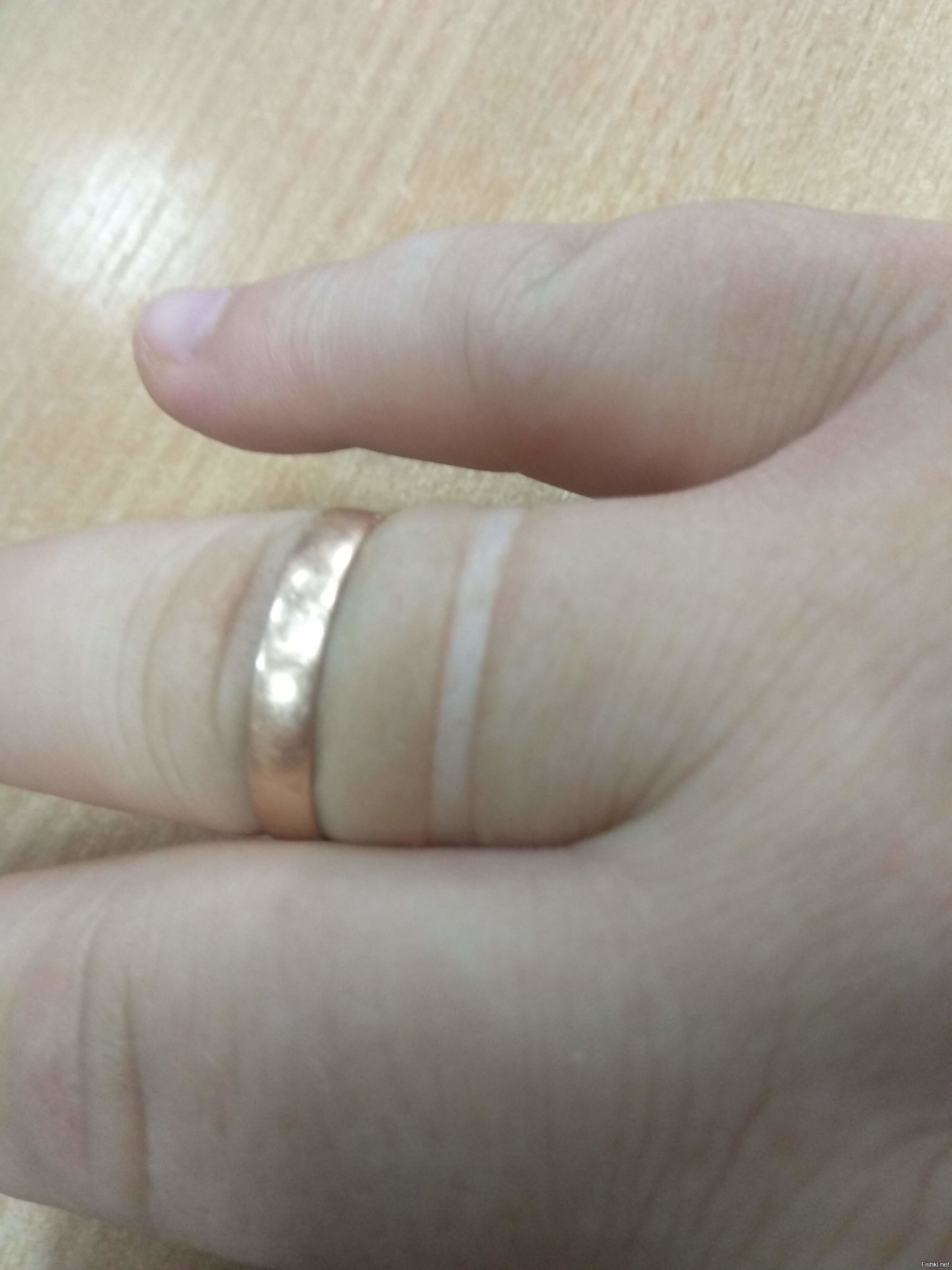 Полоса от золотого кольца. Отпечаток от кольца на пальце. Аллергия на золото кольцо. Белая кожа под кольцом.