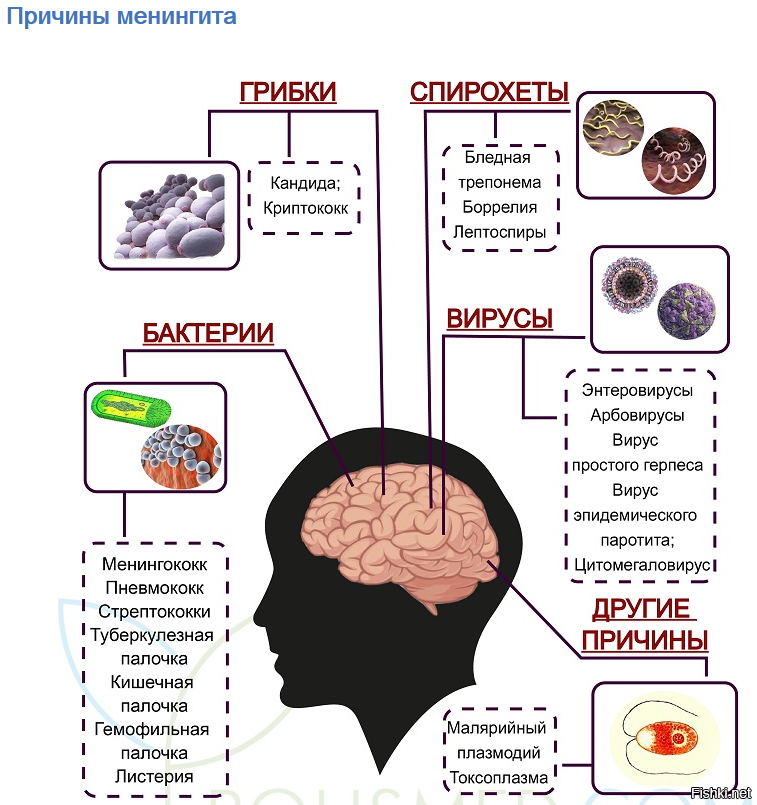 Менингит причины. Внешние проявления менингита. Менингит причины возникновения. Классификация менингитов.