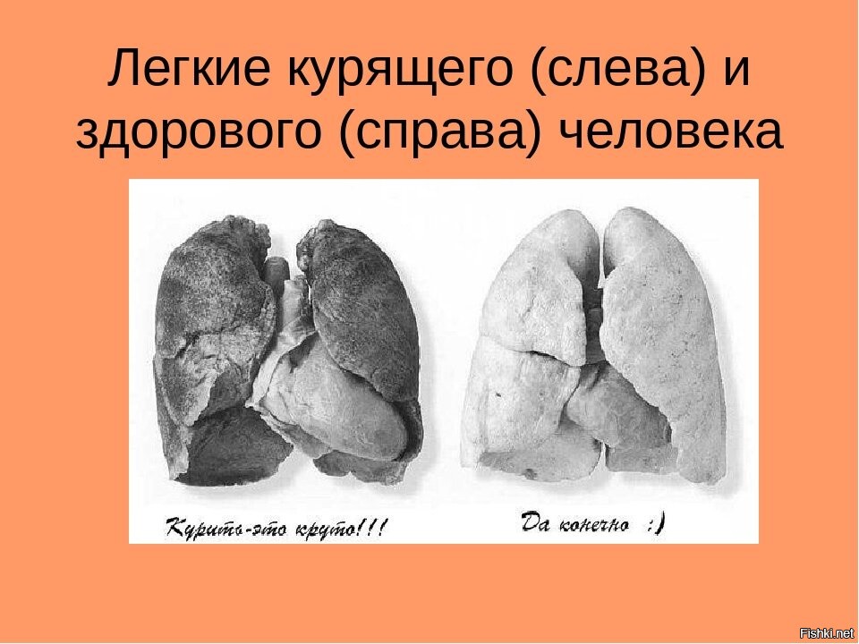 Легкие при курении картинки